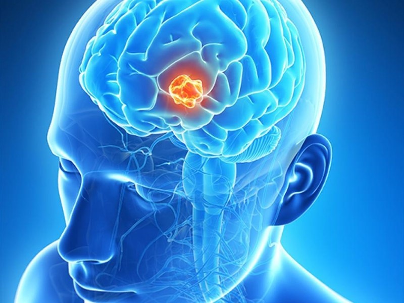 Best Neurosurgeon in Jaipur